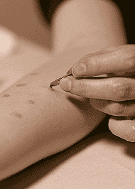 Prick test
