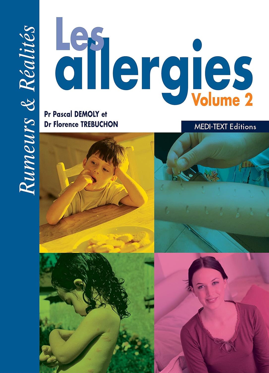 Les allergies volume 2