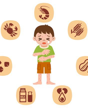 Allergies alimentaires ©ankomando shutterstock