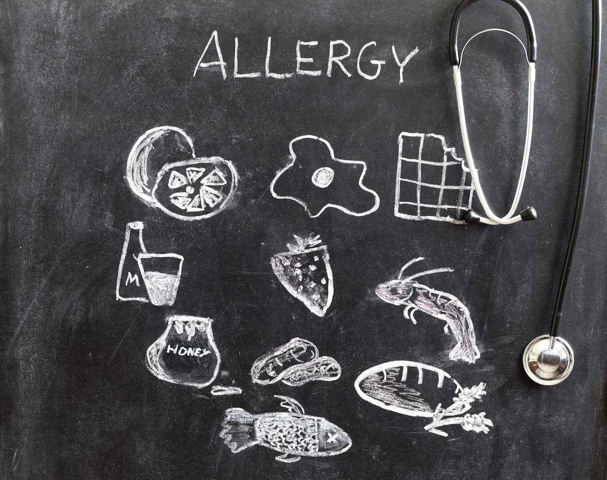 Allergies alimentaires ©udra11 shutterstock