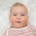 Allergies alimentaires bébé ©silentalex88 shutterstock