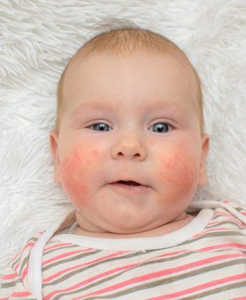 Allergies alimentaires bébé ©silentalex88 shutterstock