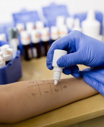 Prick test © gorillaimages shutterstock